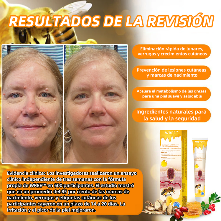 WREE™ Crema para la eliminación de verrugas y etiquetas con veneno de abeja (👨‍⚕Apta para todo tipo de piel)🐝 (🔥Último día de promoción 60% de descuento)🌷