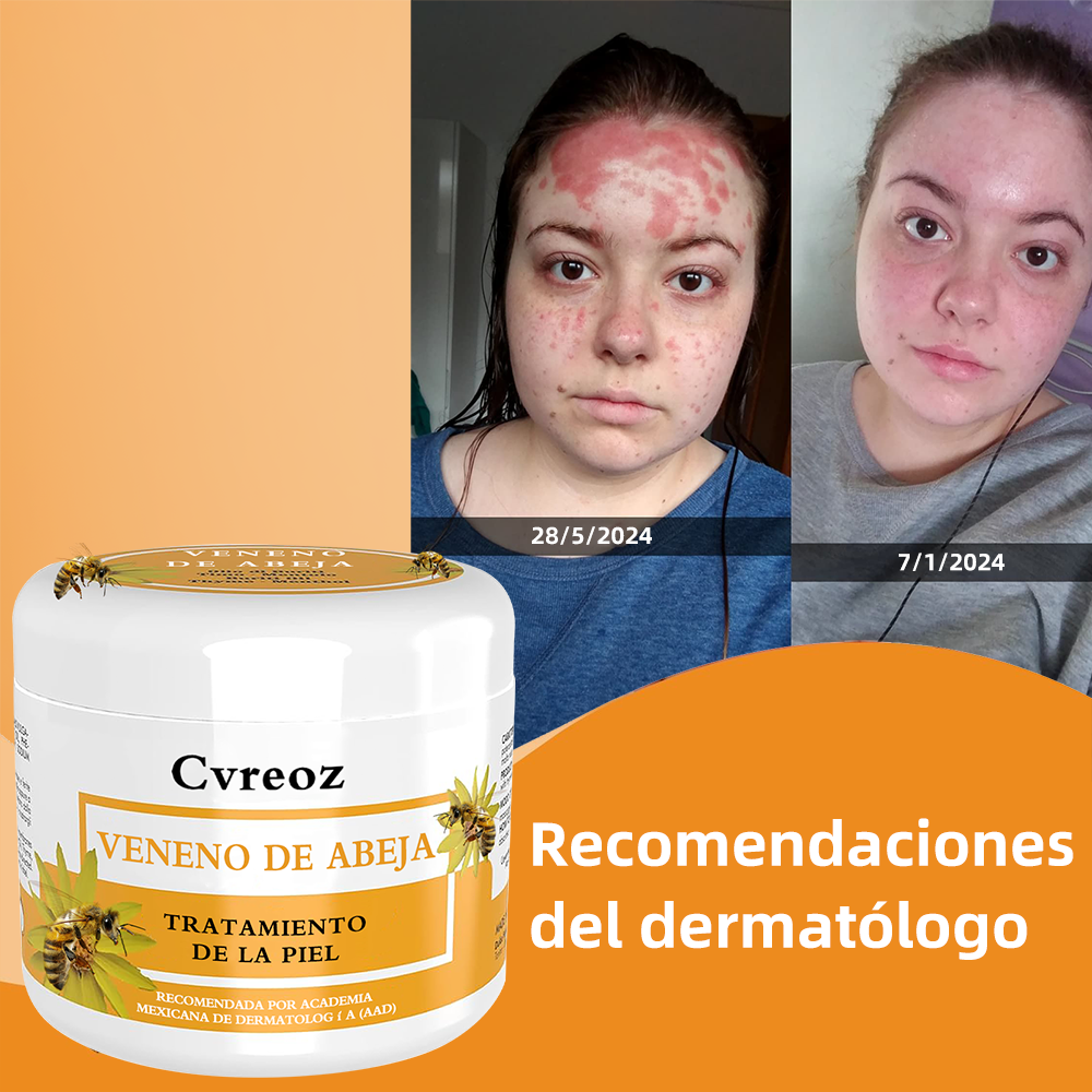 🌈Cvreoz Crema para el Tratamiento de la Piel con Veneno de Abeja (👨‍⚕ RECOMENDADA POR AMD)🐝🐝