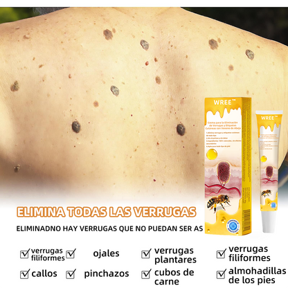 💎WREE™ Crema para la eliminación de verrugas y etiquetas con veneno de abeja (👨‍⚕Apta para todo tipo de piel)🐝 (🔥Último día de promoción 60% de descuento)