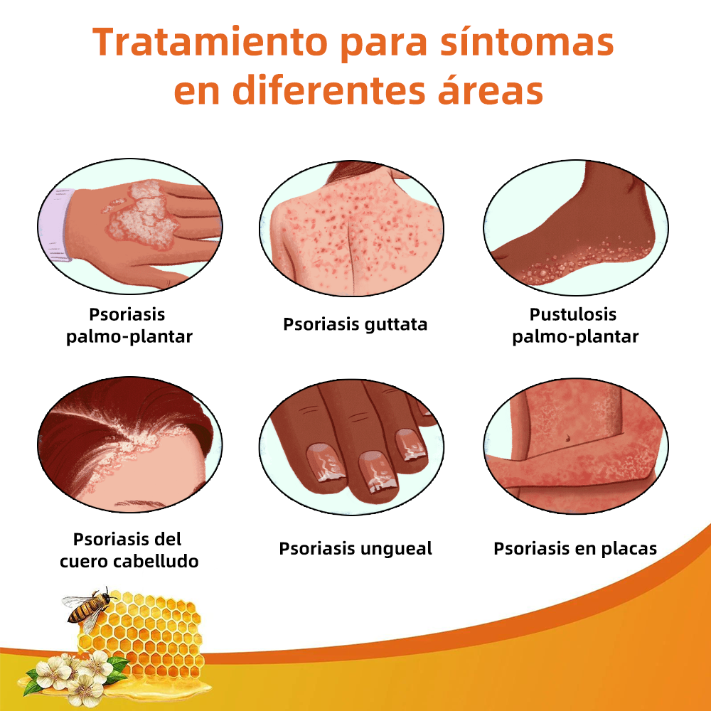 🌈Cvreoz Crema para el Tratamiento de la Piel con Veneno de Abeja (👨‍⚕ RECOMENDADA POR AMD)🐝🐝