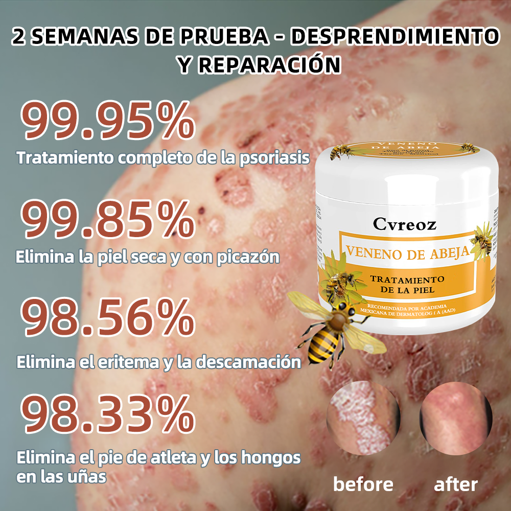 🌈Cvreoz Crema para el Tratamiento de la Piel con Veneno de Abeja (👨‍⚕ RECOMENDADA POR AMD)🐝🐝